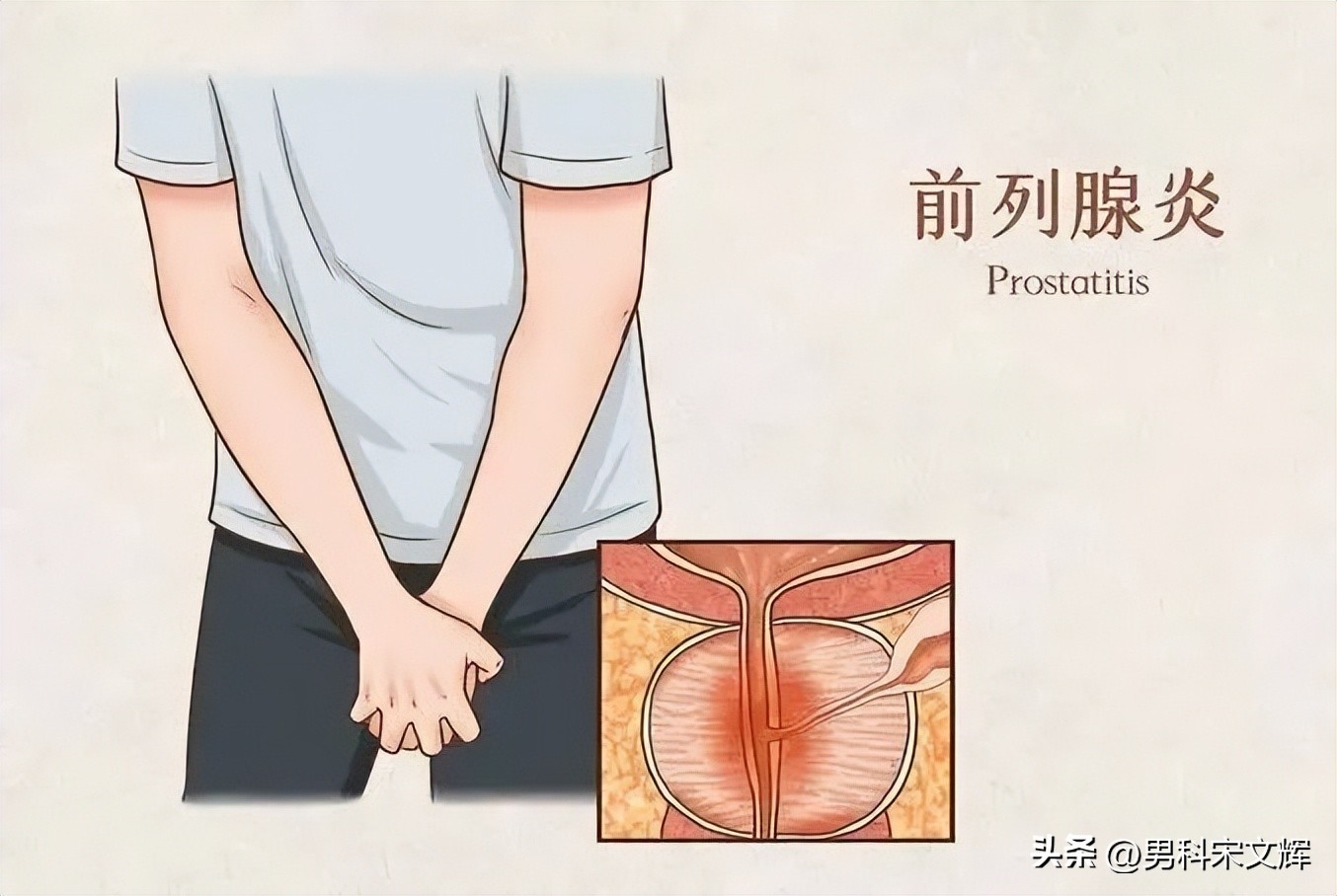 天津看男科前列腺哪家比较好,天津看前列腺哪家医院好一些