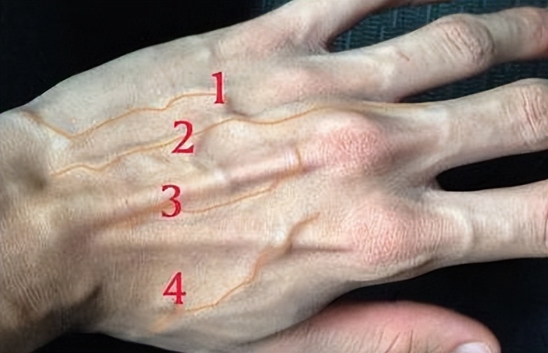 胳膊青筋手背青筋多是怎么回事,人体青筋明显是什么问题