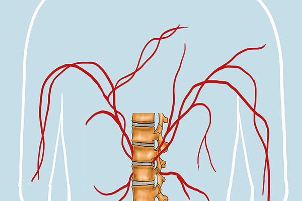 稍微累点就后背疼怎么治疗,累一点就后背疼痛是什么原因