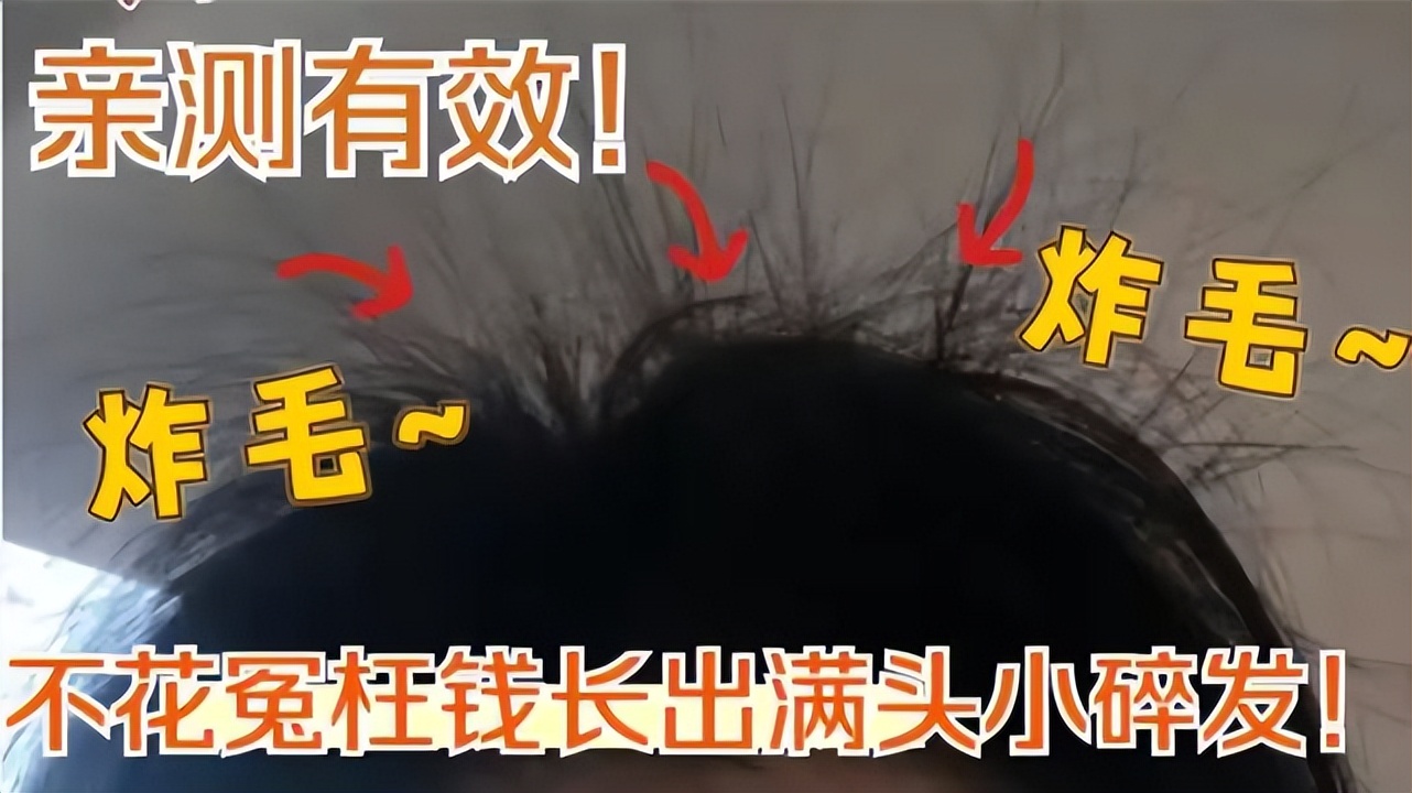 全网最好的防脱生发洗发水,洗发水推荐防脱生发改善毛躁