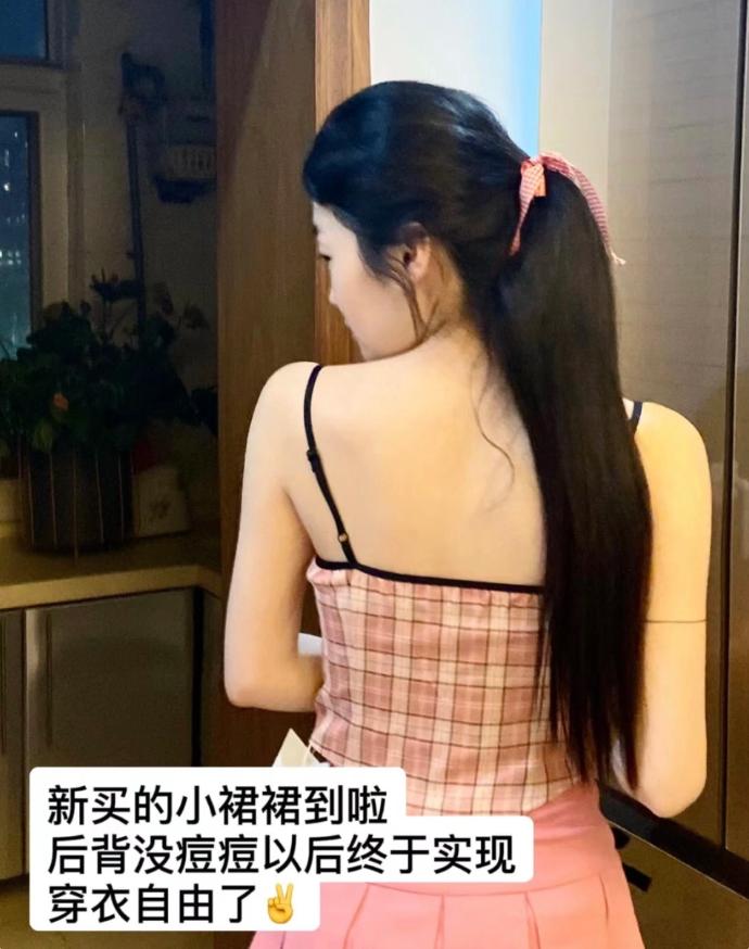 后背生疮是什么原因引起的,后背痤疮发痒怎么办