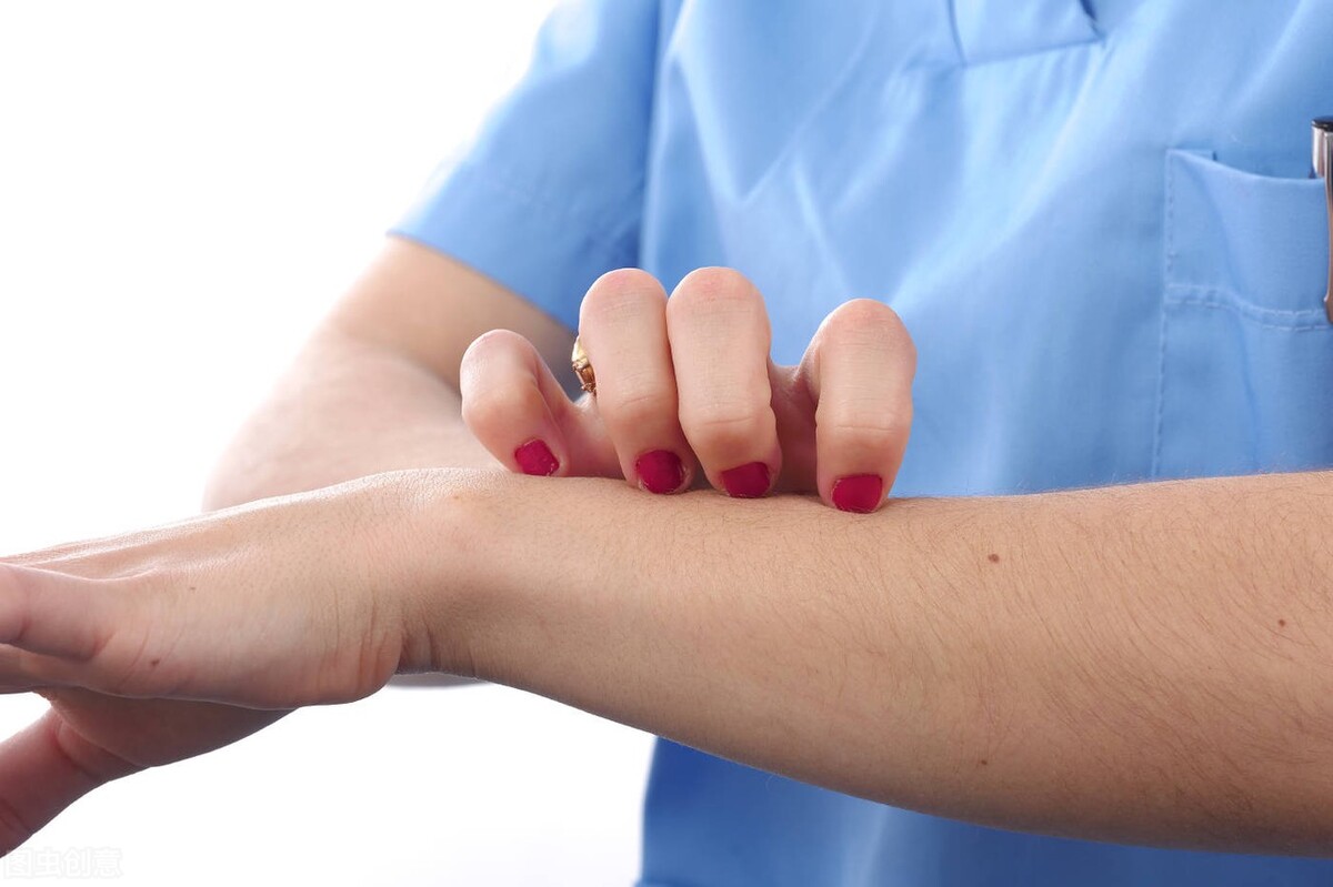 荨麻疹反反复复遇热就严重,麻疹越挠越多