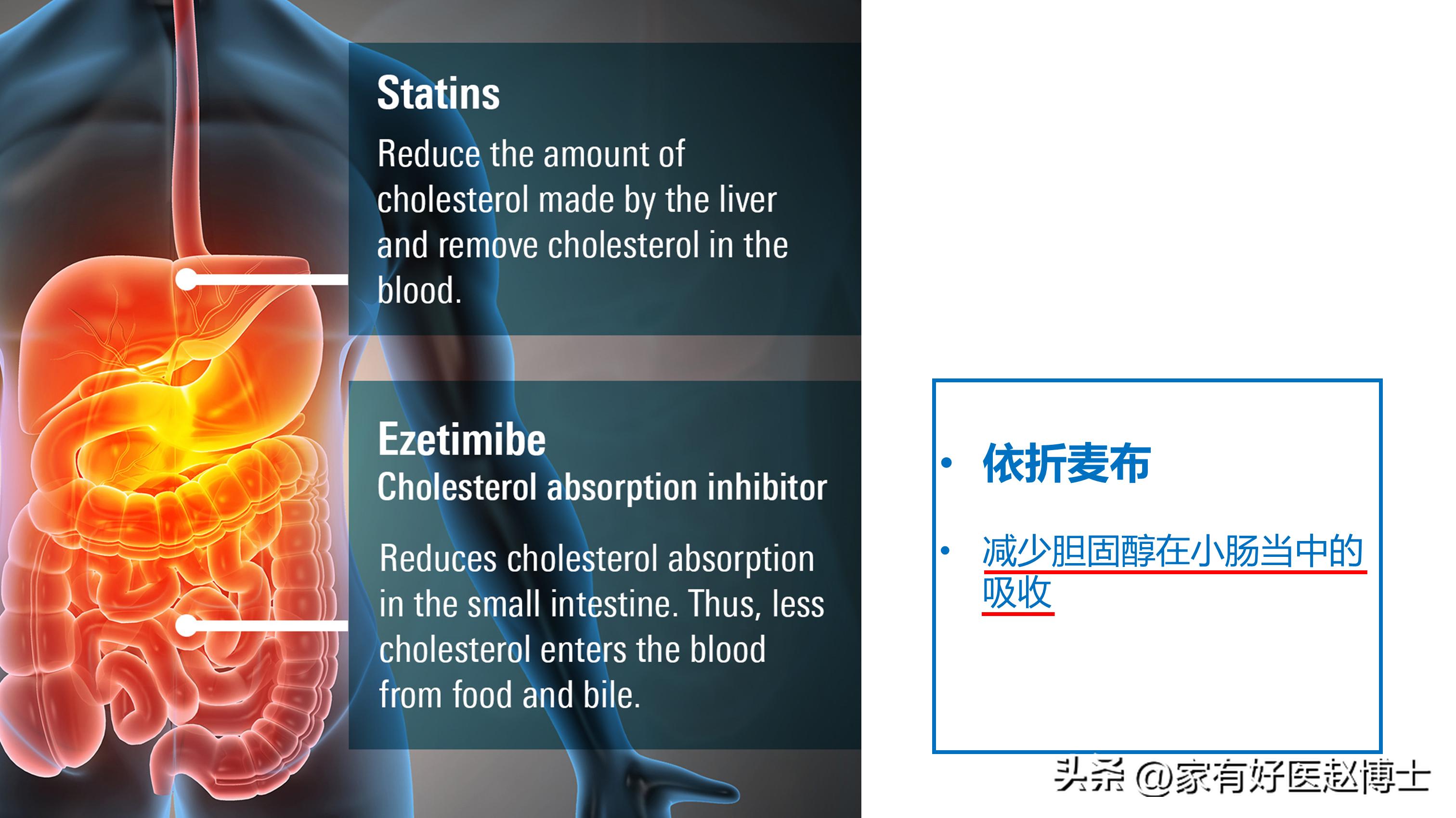 胆固醇高喝什么茶辅助降,胆固醇多高才需要用药