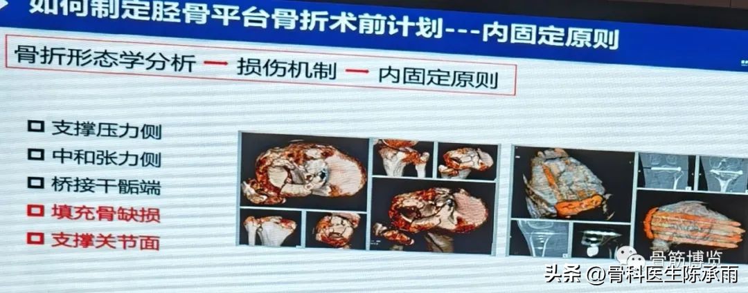 国家卫健委主办的骨创伤专项能力培训项目----下肢损伤学习班