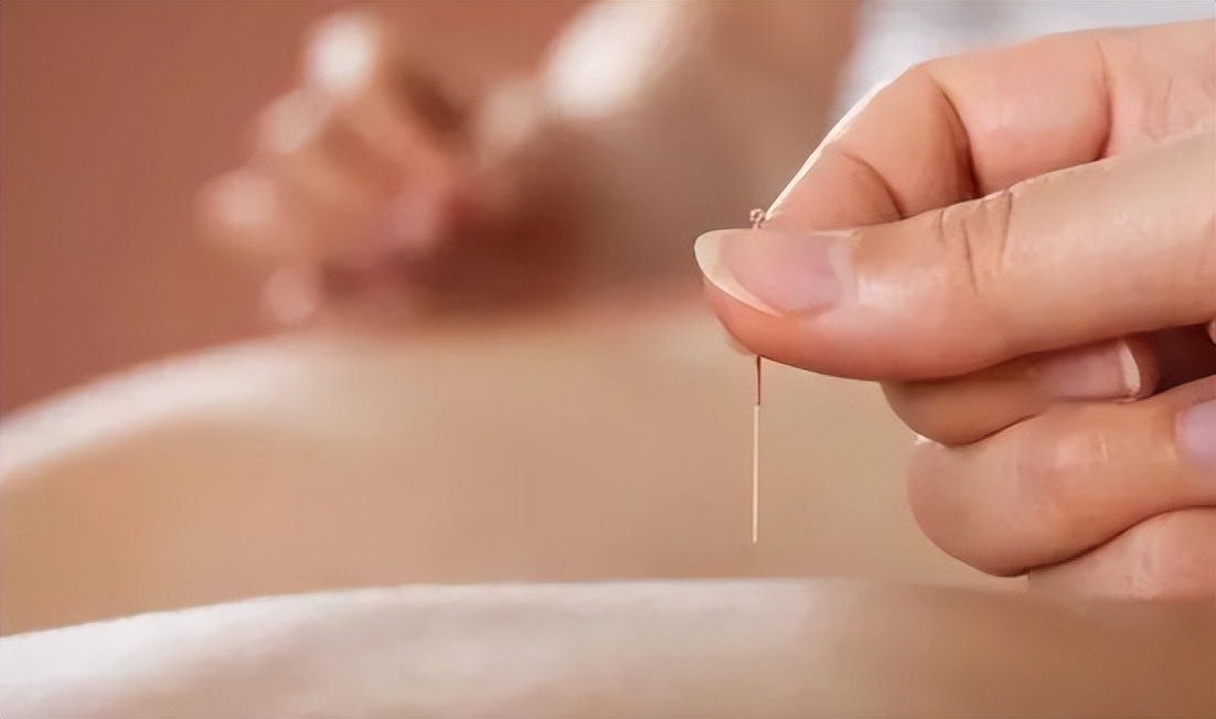 喉咙痛咳嗽针灸如何取穴,头痛针灸哪个穴位快速止痛