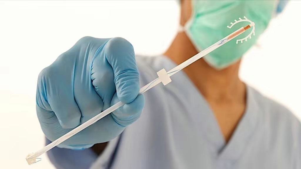 女性上环的真实原理,女性上环之前的注意事项