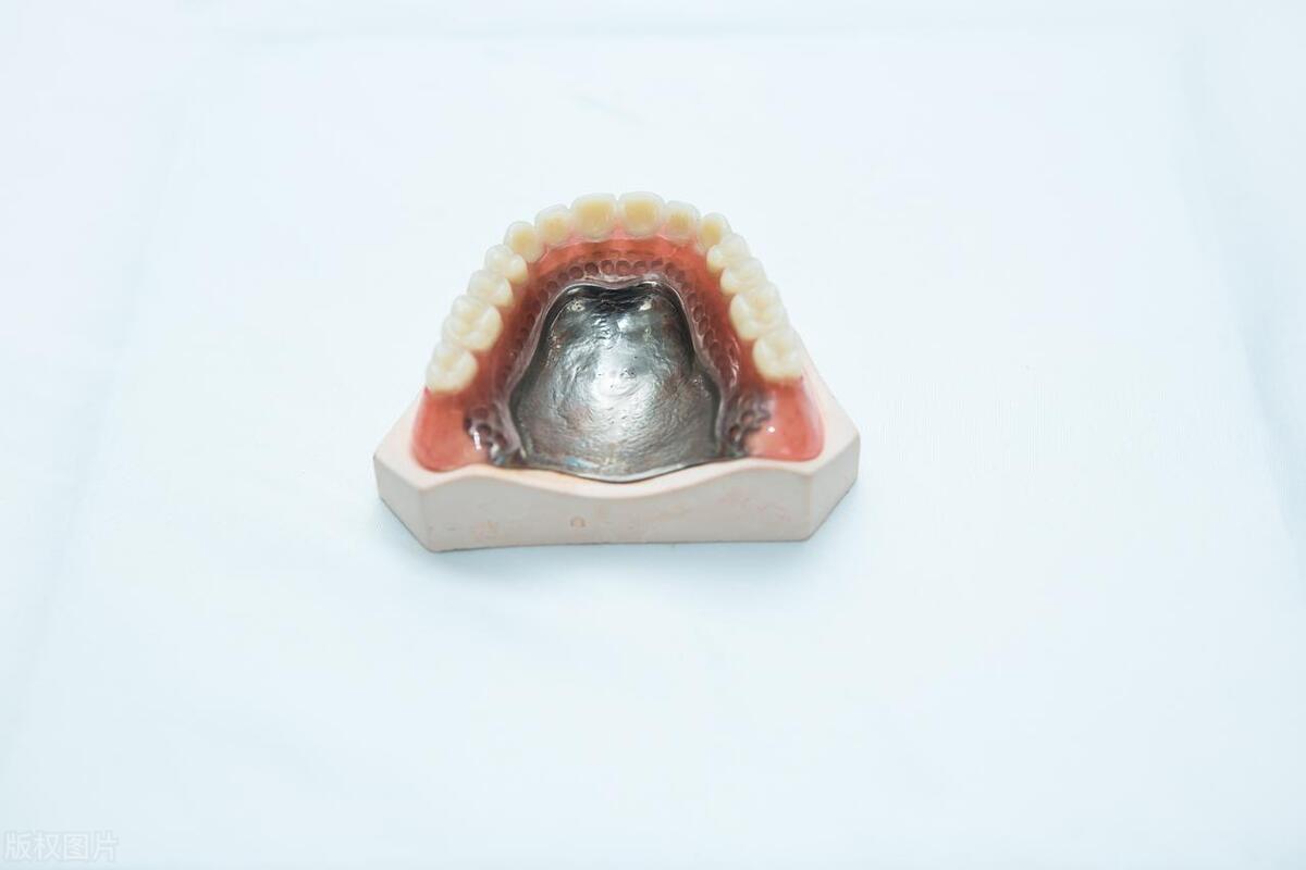 种牙好还是活动假牙好,70岁牙齿掉光种牙还是活动假牙