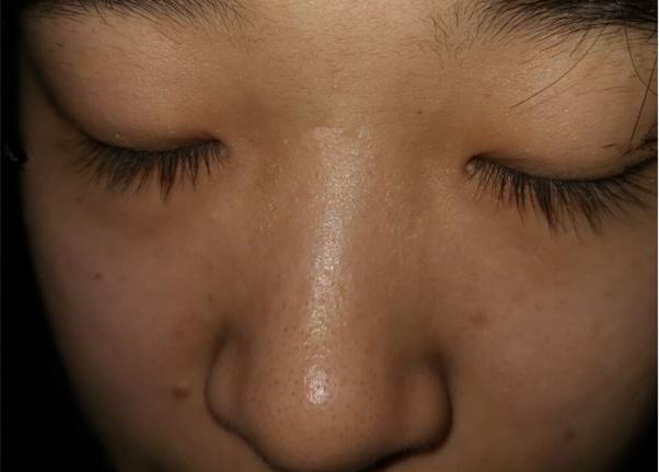 男人脸黑红是怎么回事,脸又黑又肿是什么原因