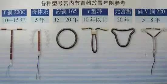 宫内节育器的特点及适用人群,宫内节育器术前准备