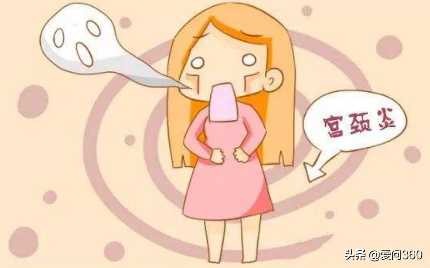 宫颈常见问题及预防有哪些,得了宫颈炎要注意什么呢