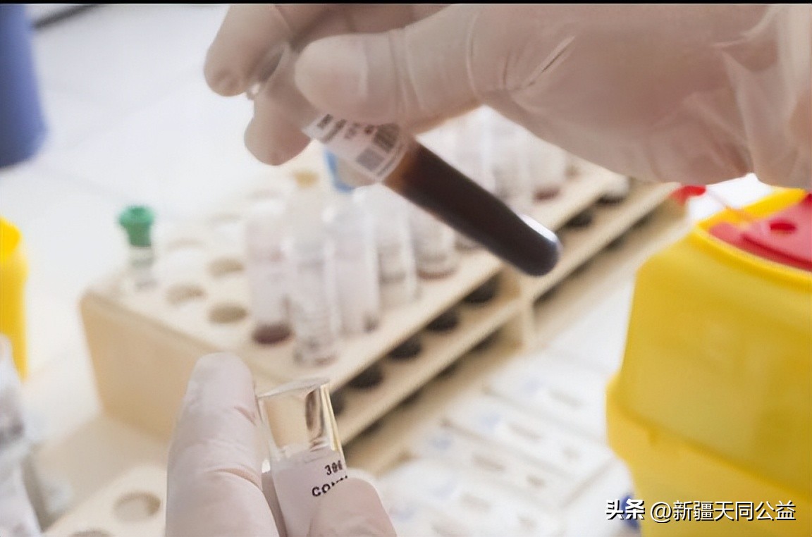 泰国你不知道的艾滋病天堂,泰国艾滋病最高的地方