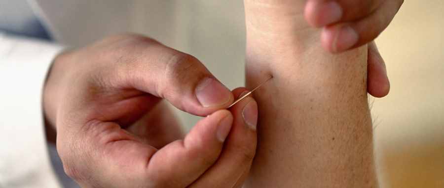 中医无痛治疗?芒针治疗中风后的寒热错杂型消化不良疗效相关研究