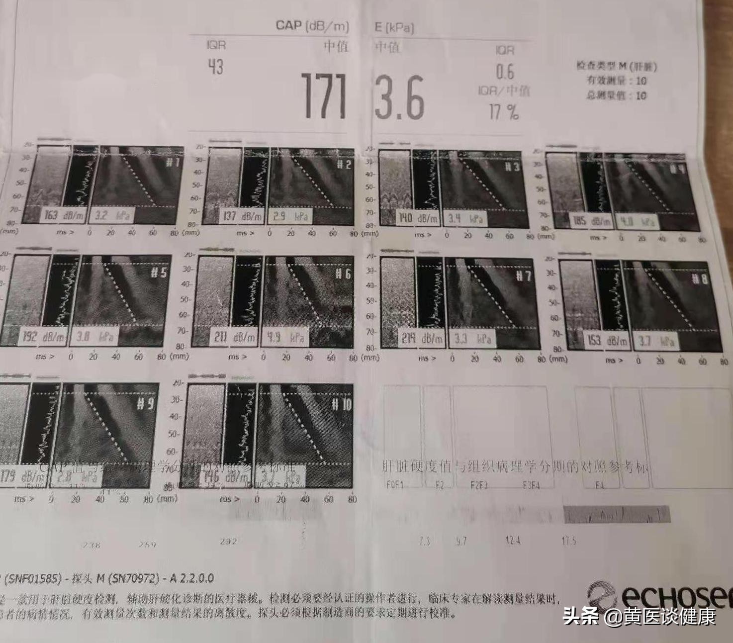 小三阳肝功能正常dna2次方,小三阳肝功能正常dna低于1000