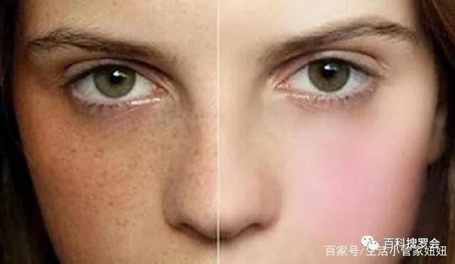 黛维依祛斑加盟要多少钱,加盟黛维依多少钱