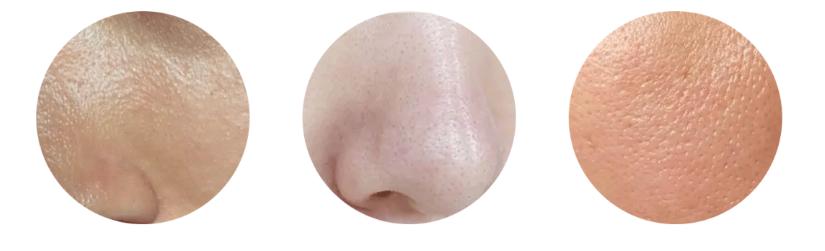 拒做油美人7招告别脸部油腻,夏日控油五步走法