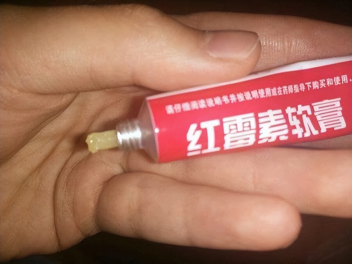 罗红霉素软膏的注意事项,红霉素软膏都可以治哪些病