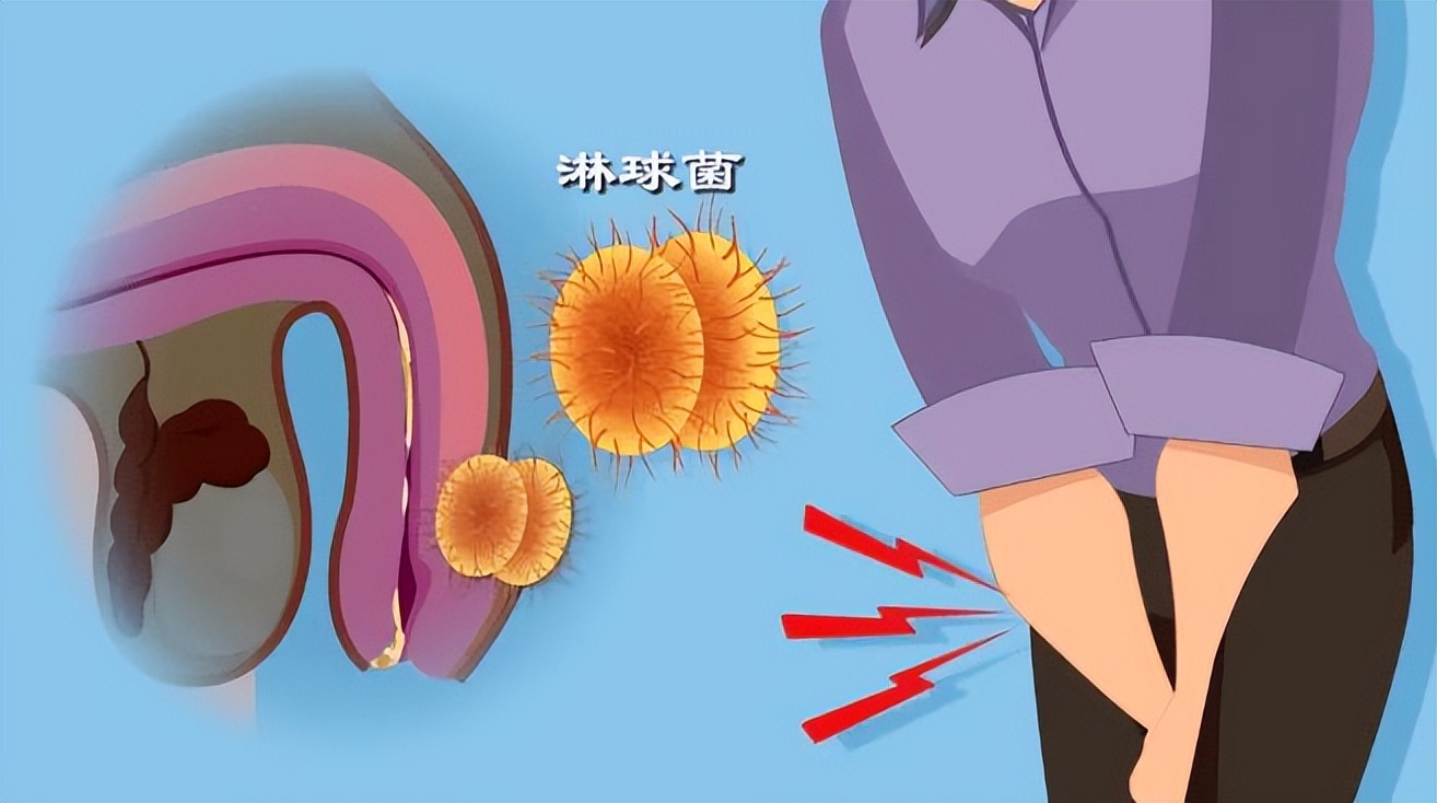 可以通过性传播的疾病有哪些,能通过性传播的疾病有哪些