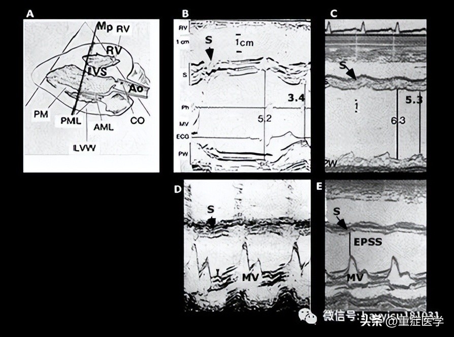 休克评估与处理课件,休克评估最有效指标