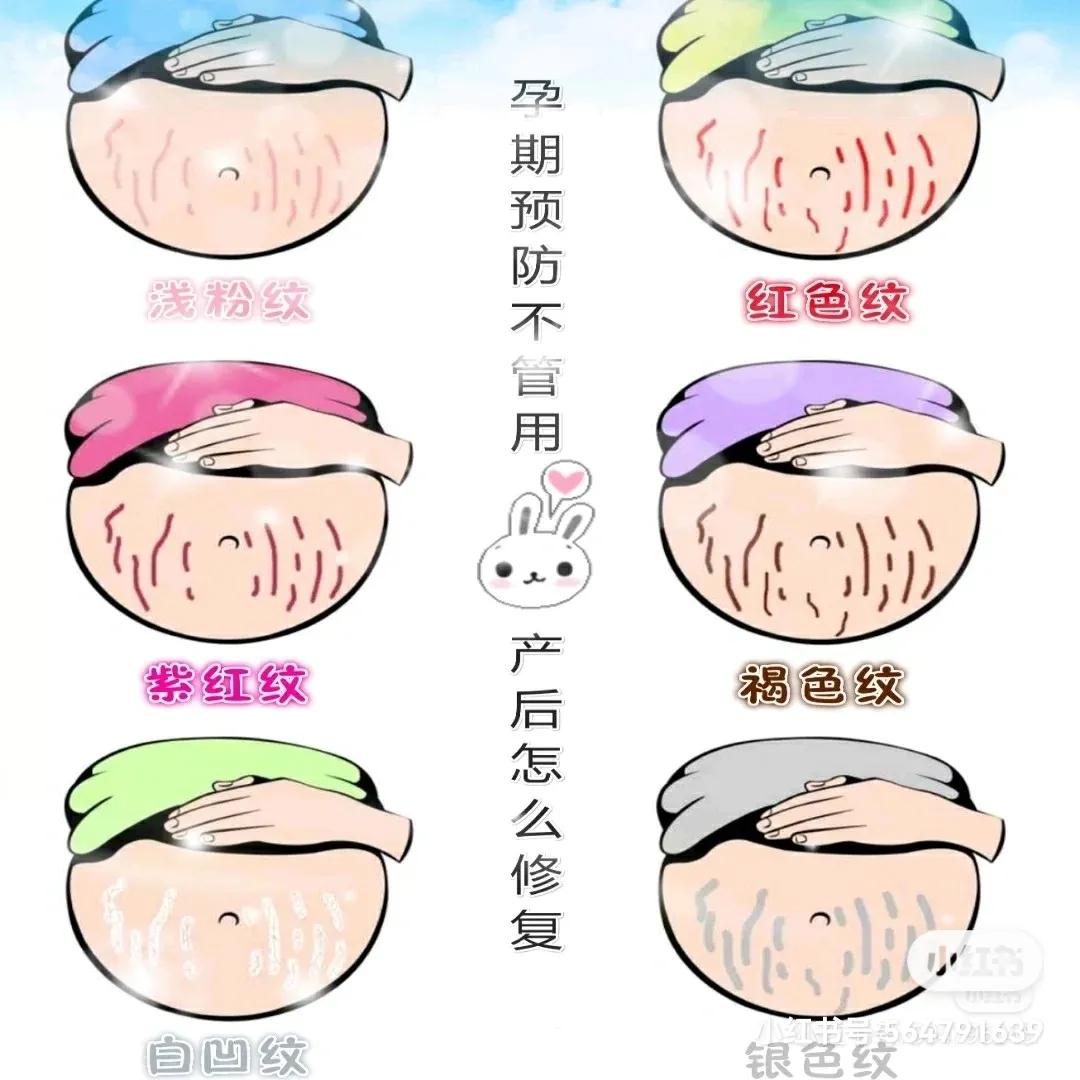 马油可以预防妊娠纹吗,妊娠油真的可以预防妊娠纹吗