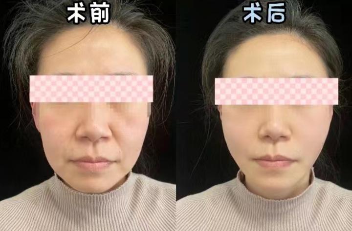 八大处医院杨喆抖音,八大处整形医院杨喆