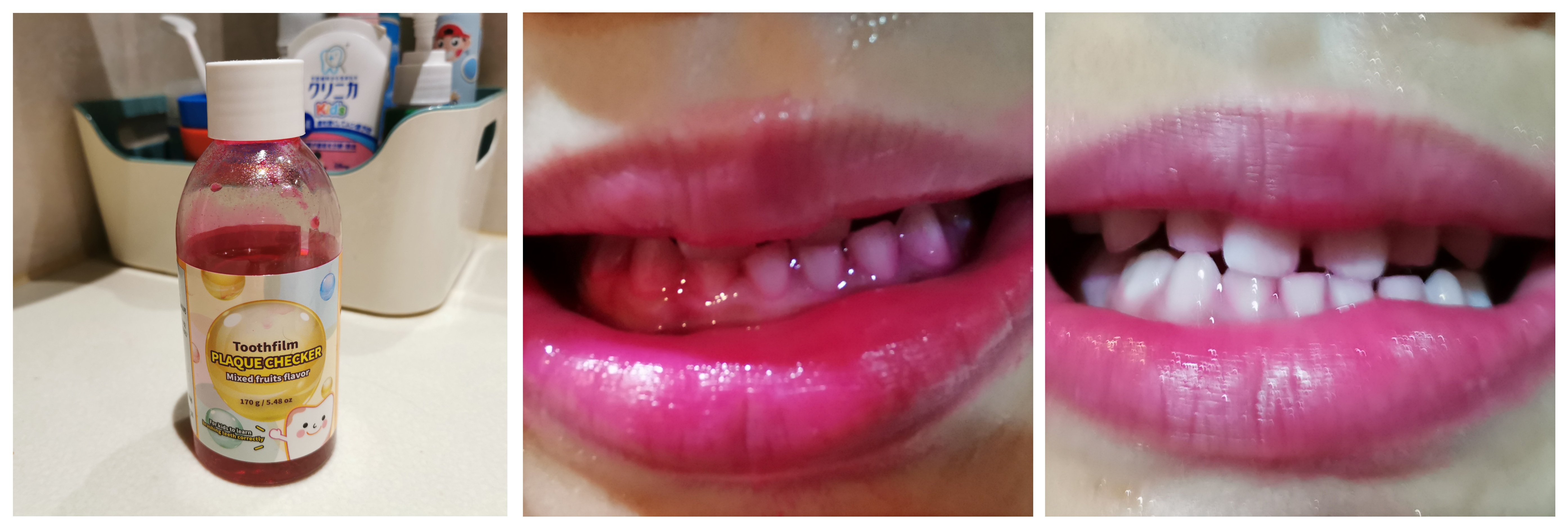 哪个牌子的电动牙刷好用不伤牙,儿童电动牙刷护牙怎么选