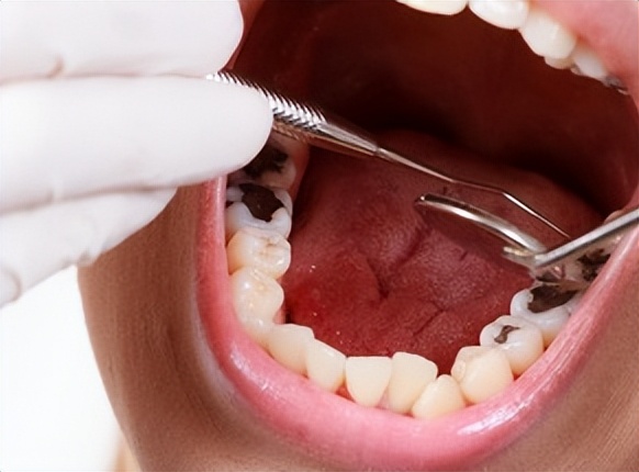 牙科恐惧症如何缓解,牙科焦虑症和牙科畏惧症