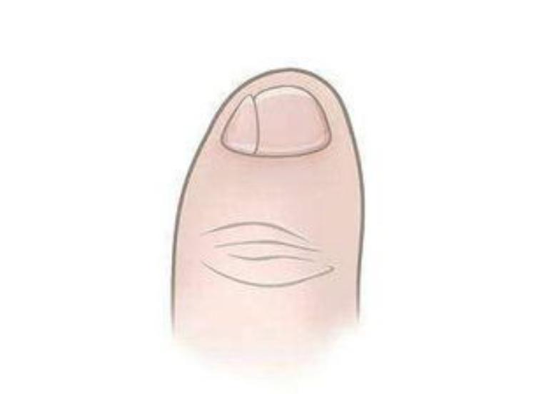 华夏子孙的3个印记:门牙、褶子和脚趾,与生俱来且无法抹去