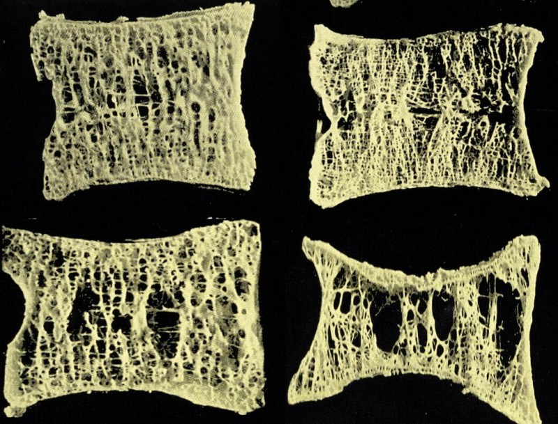 老人每天锻炼的黄金时段,静养的老人比运动的老人更长寿吗