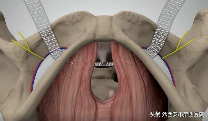 健康中国行动详解,健康中国2030真的吗