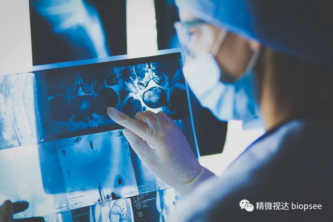 精微视达医疗科技,精微视达医疗科技销售代理