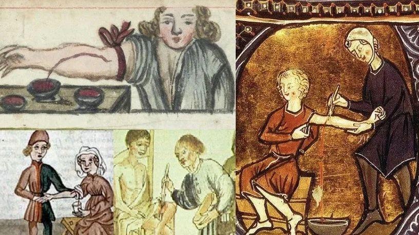 中世纪暗黑荒诞医学史,脑洞大开医疗