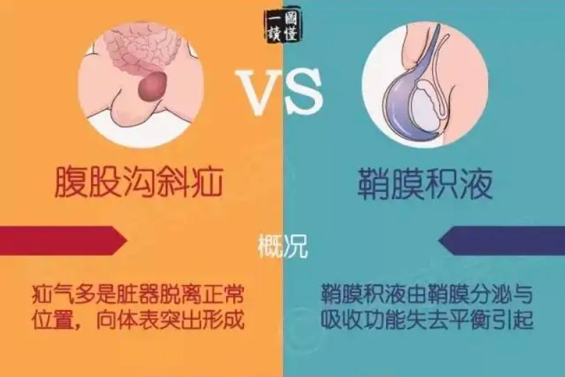 省妇幼鞘膜积液,洛阳妇幼保健院鞘膜积液微创