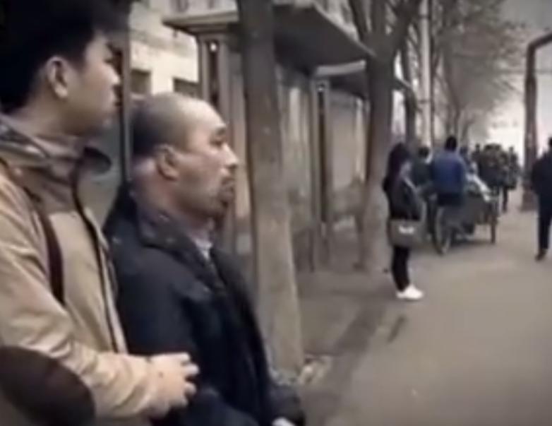 男子喝酒脖子成河马,喝酒喝成河马脖子病