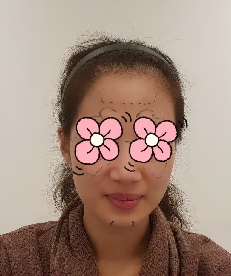 五官扁平脸怎么变高级感,扁平脸塌鼻子怎么改善