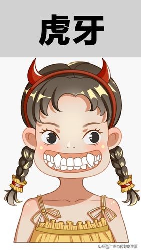 老虎牙矫正最快的方法,老虎牙矫正方法