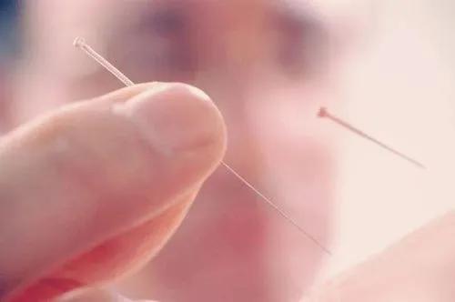 头部脑供血不足穴位,头部穴位针灸的作用