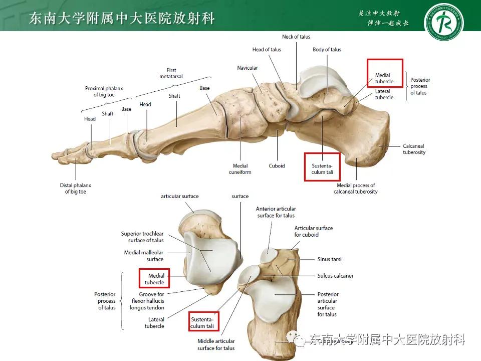 好文分享-《肌骨系统疾病——副舟骨综合征》