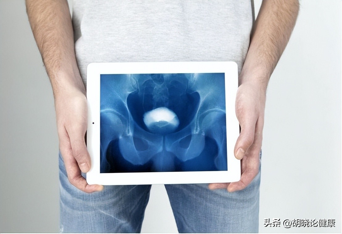 尿路结石的饮食要注意些什么,小儿尿路结石常见症状