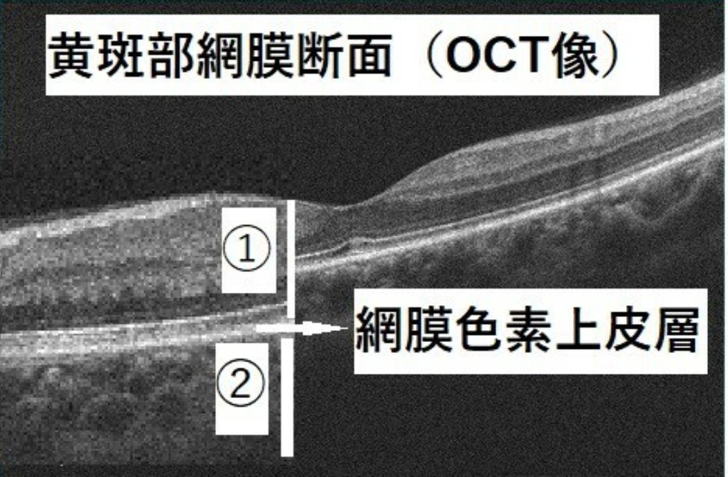 ips细胞的未来,日本ips细胞计划