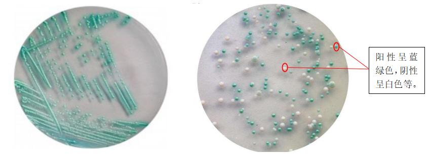 白色念珠菌感染是真菌感染吗,真菌细菌感染鉴别诊断