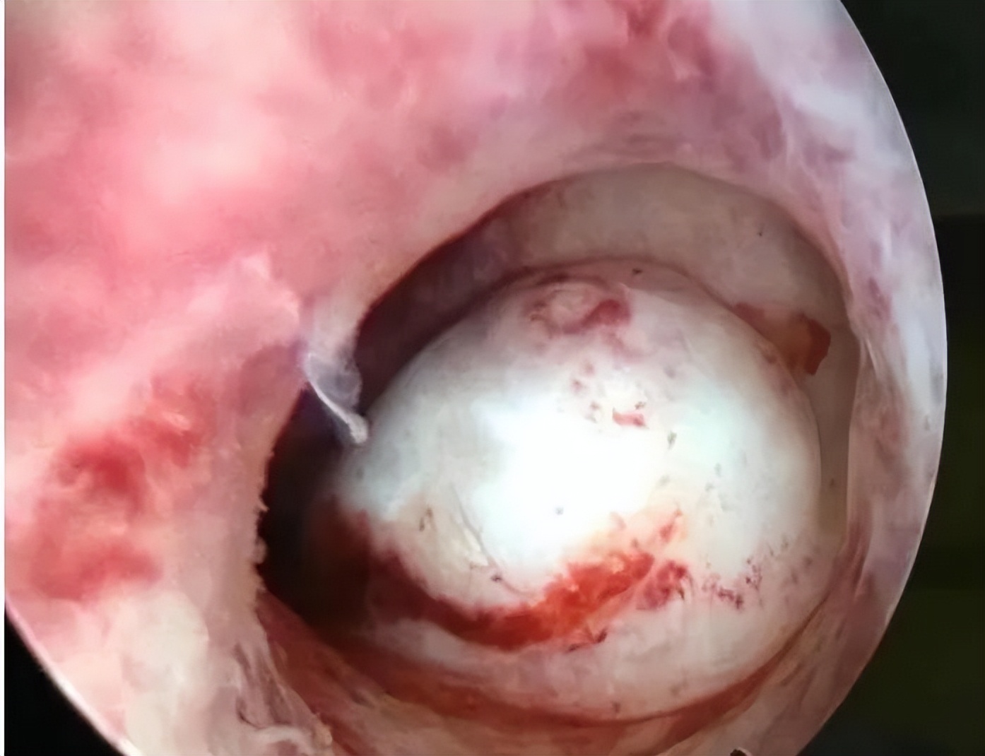 宫腔镜最好的医生,妇科医生科普的14个妇科知识