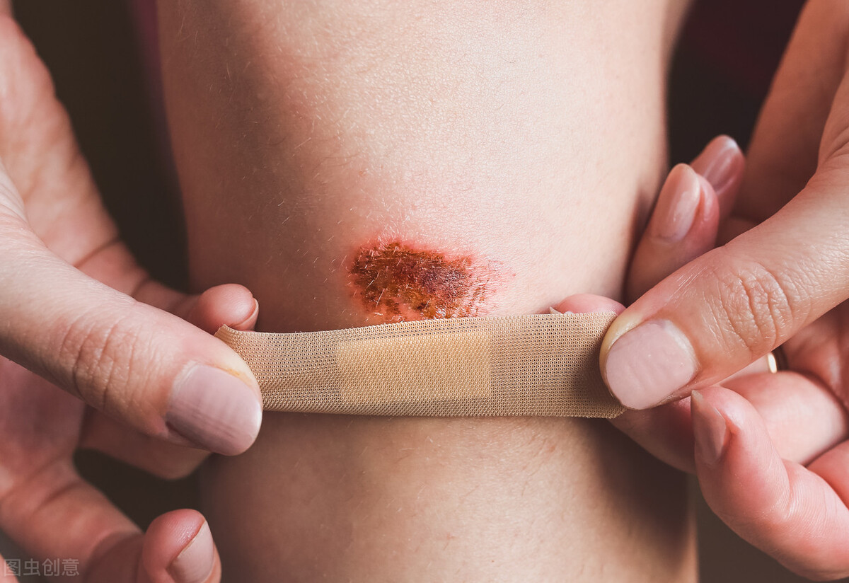 创可贴的基础知识,才知道创可贴还能有这样的好处