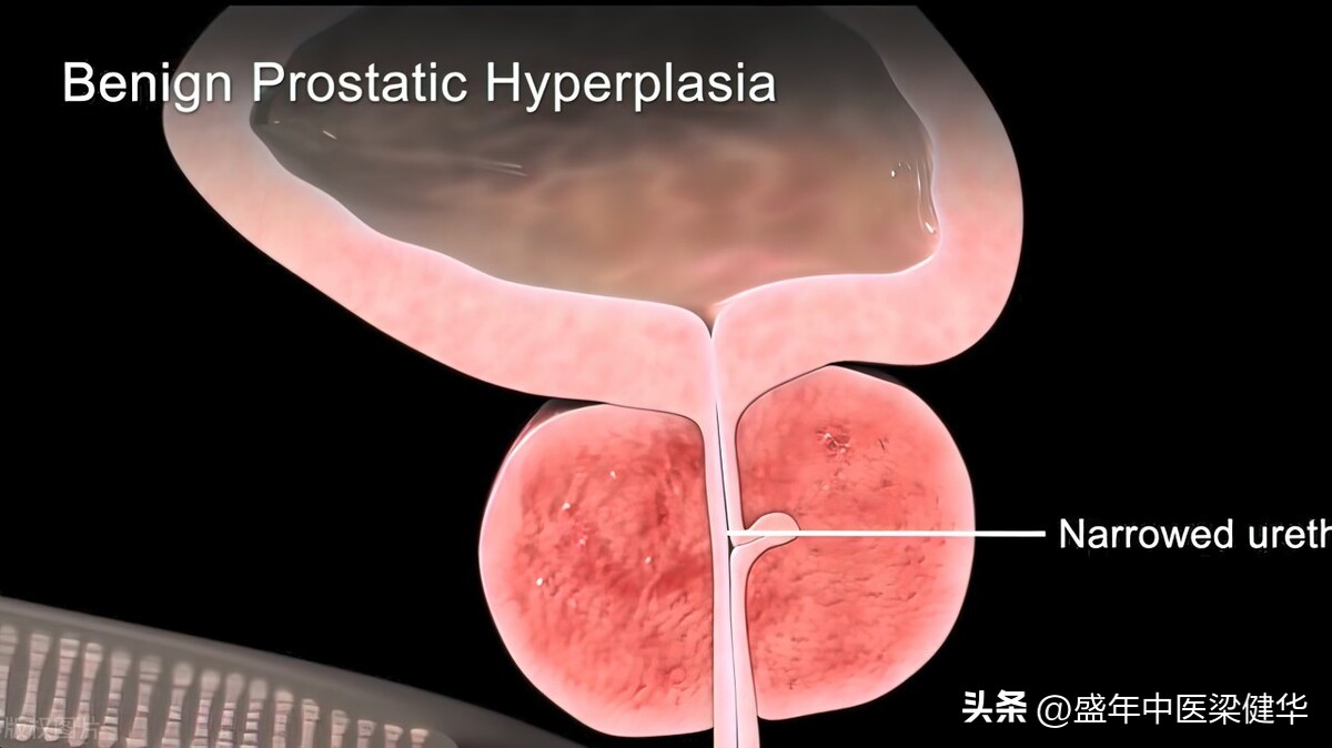 大便干燥夜尿多乏力疲劳中医辨证,夜尿多黑眼圈中医辨证治疗