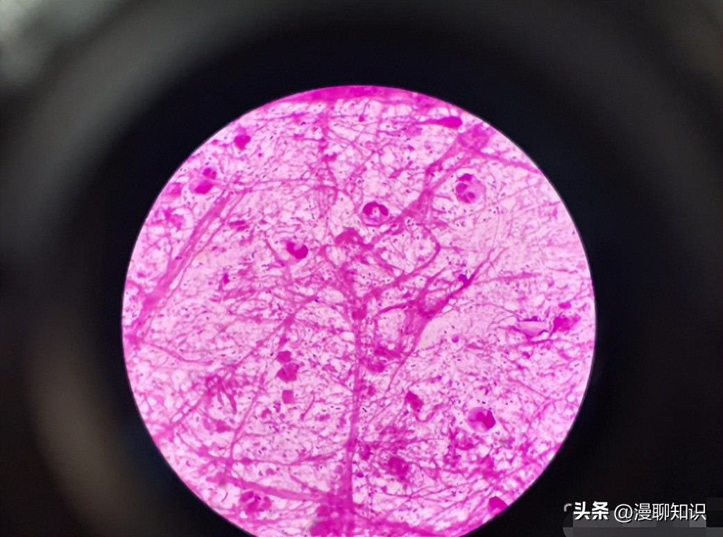 老年人得了肺炎应如何有效医治,肺炎有多严重怎么办