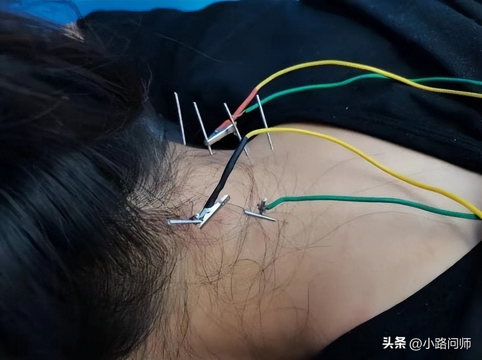 压力性尿漏怎么样能治,压力性尿湿症