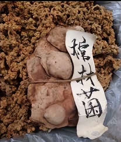 村民挖到肉灵芝是什么,村民挖到肉灵芝后续