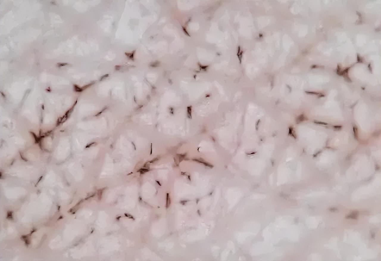 脸泛红是洗面奶的原因吗,为什么用完洗面奶脸会变白