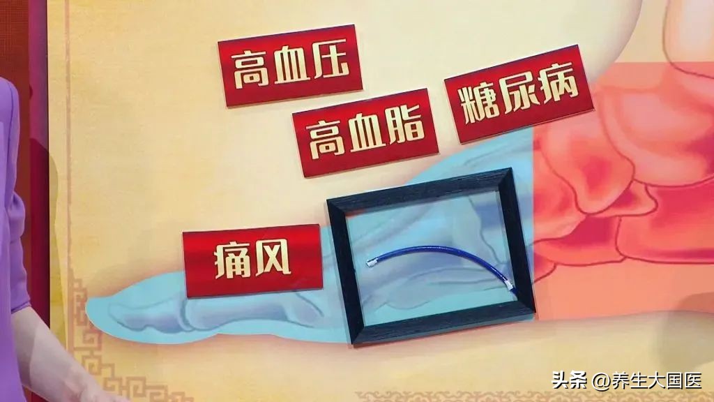 手脚血管突然明显凸起,心脏血管三高怎么预防