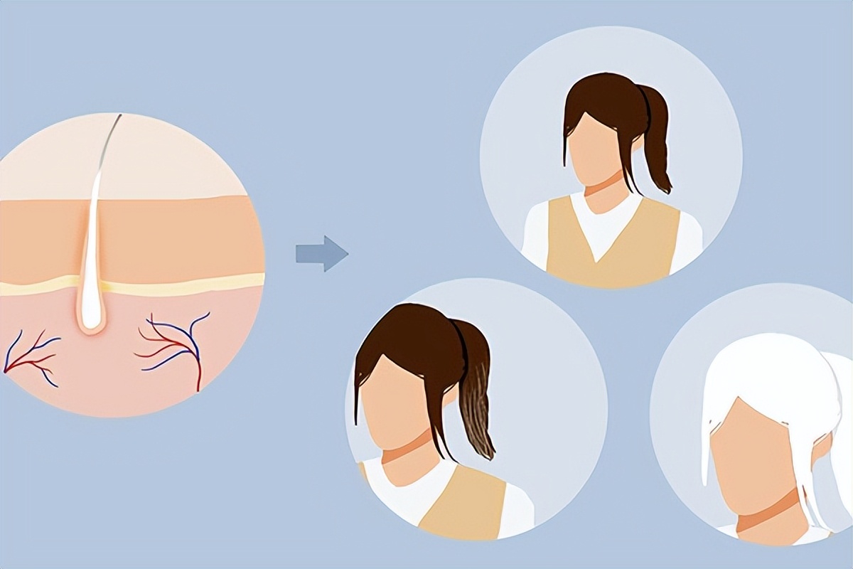 鼻毛白了拔掉了会引起其他变白吗,鼻毛变白跟肺有关系吗