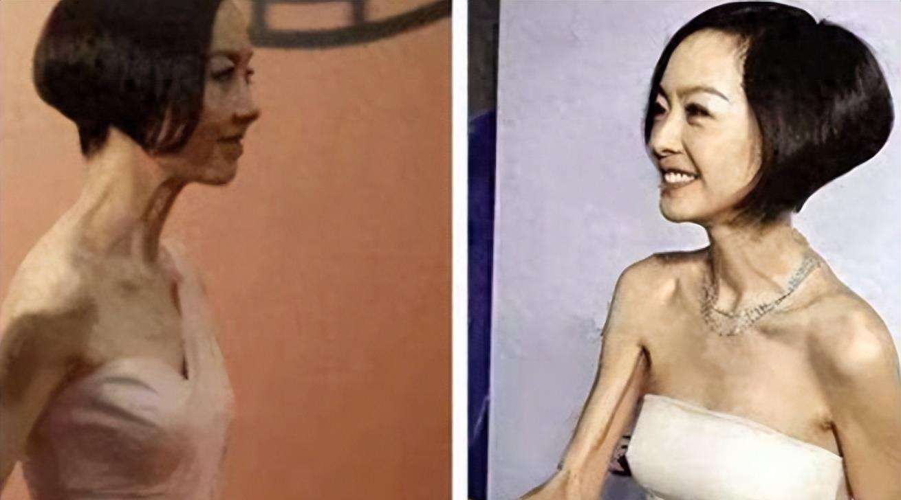 瘦到病态的审美,瘦到病态